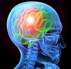 What Is Traumatic Brain Injury?