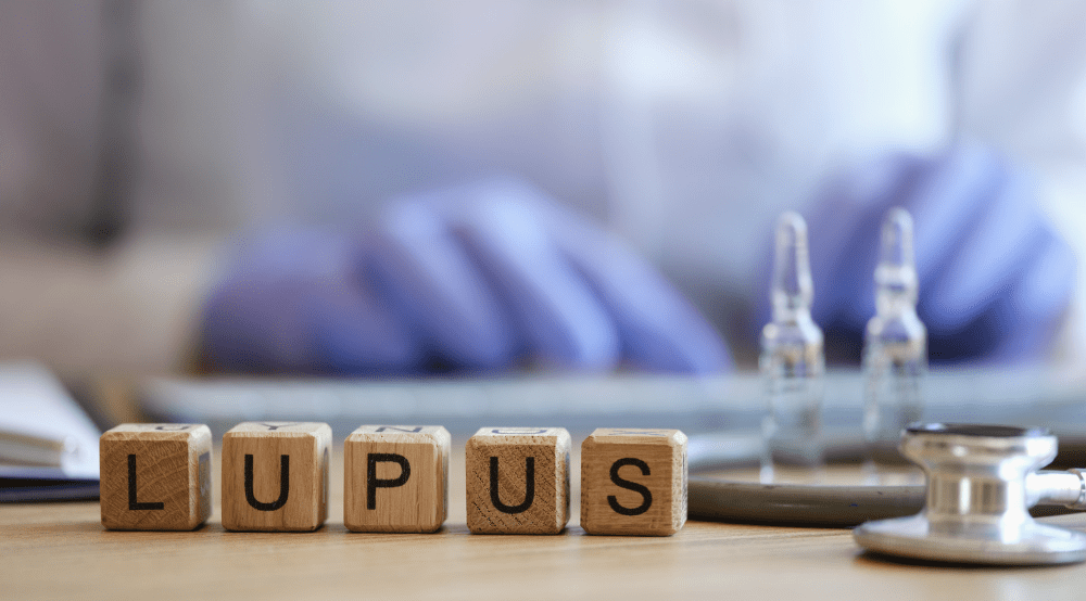 Can I Get VA Disability Benefits for Lupus? 